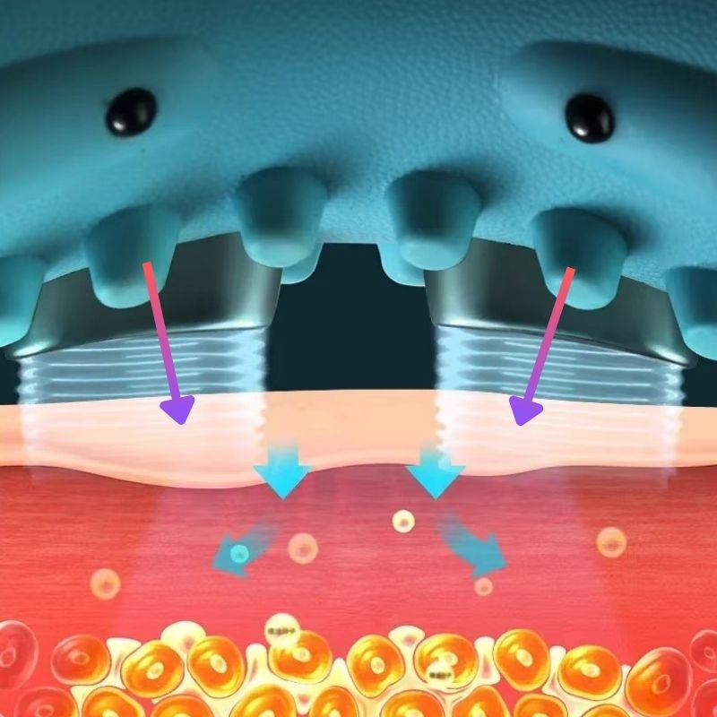 כרית עיסוי EMS לצוואר – הקלה חכמה לעמוד השדרה הצווארי (Cervical Spine)